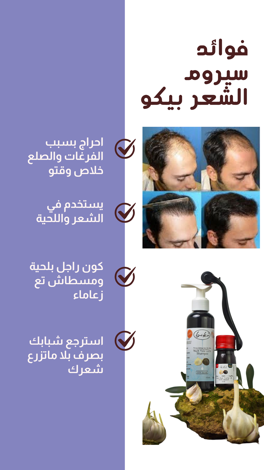 شامبو وزيت ذكر الثوم الأسود biko - Image 3